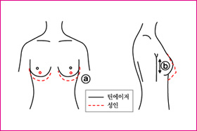 바스트 형태1